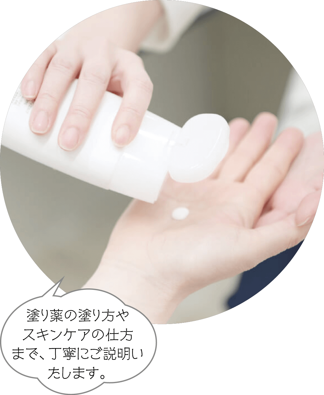 塗り薬の塗り方やスキンケアの仕方まで、丁寧にご説明いたします。